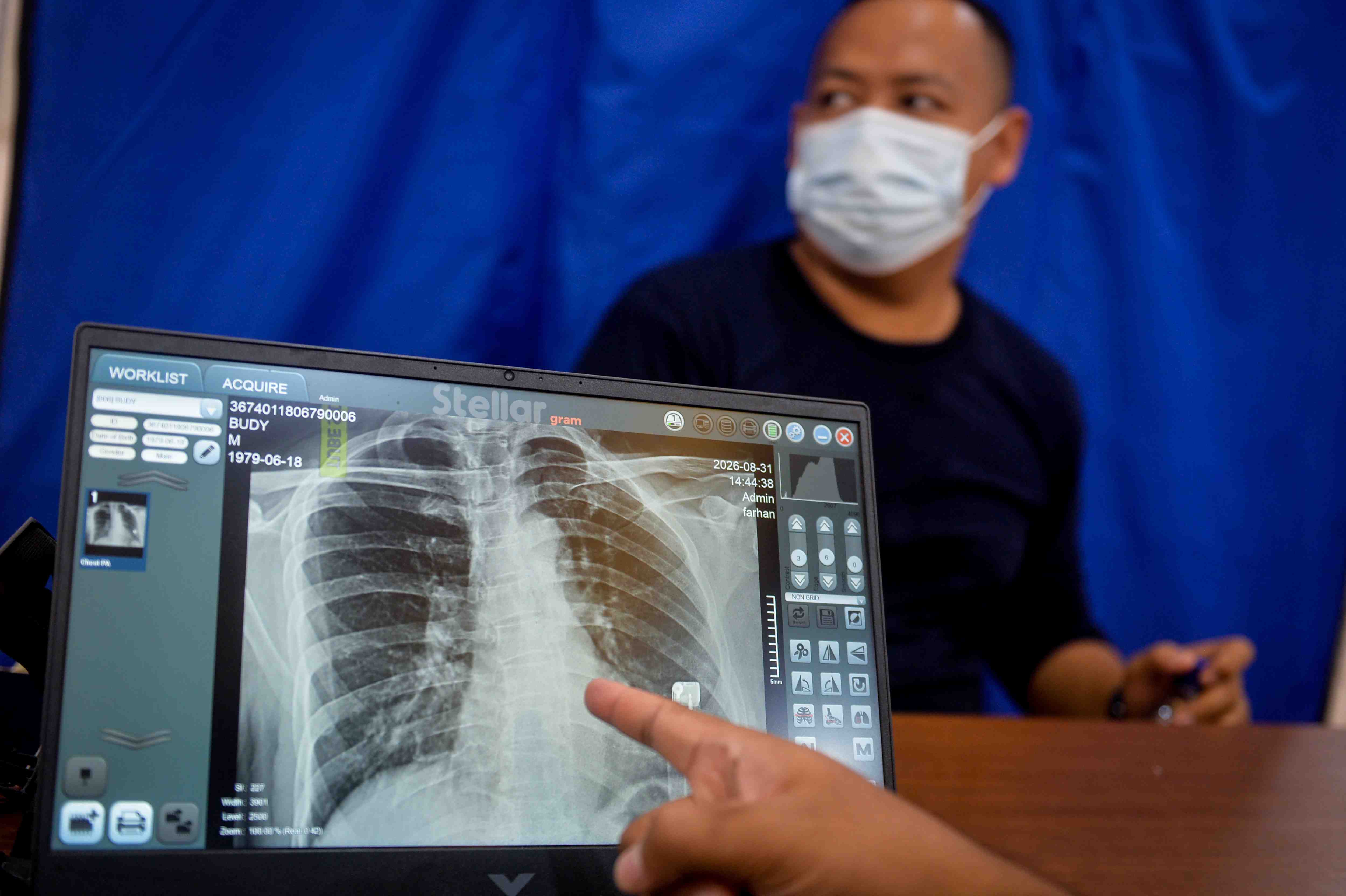 CAPAIAN PROGRAM CEK KESEHATAN GRATIS
