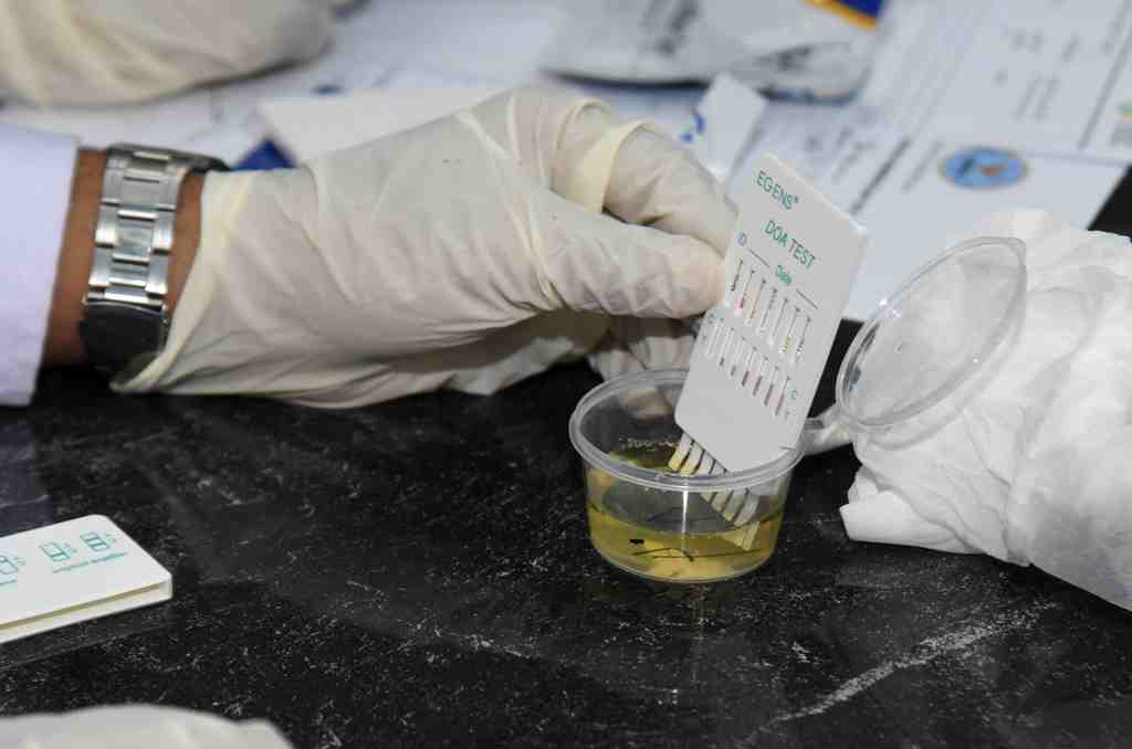 TES URINE