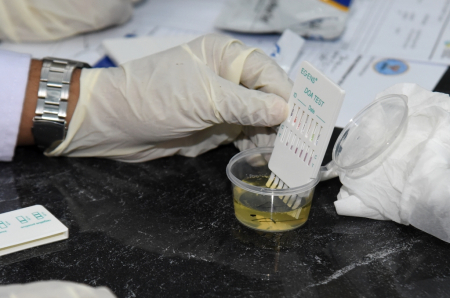 TES URINE