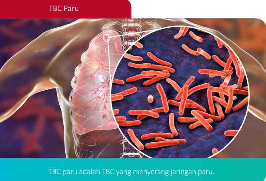 Gotong Royong Eliminasi TB: Wujudkan Indonesia Sehat untuk Generasi Mendatang