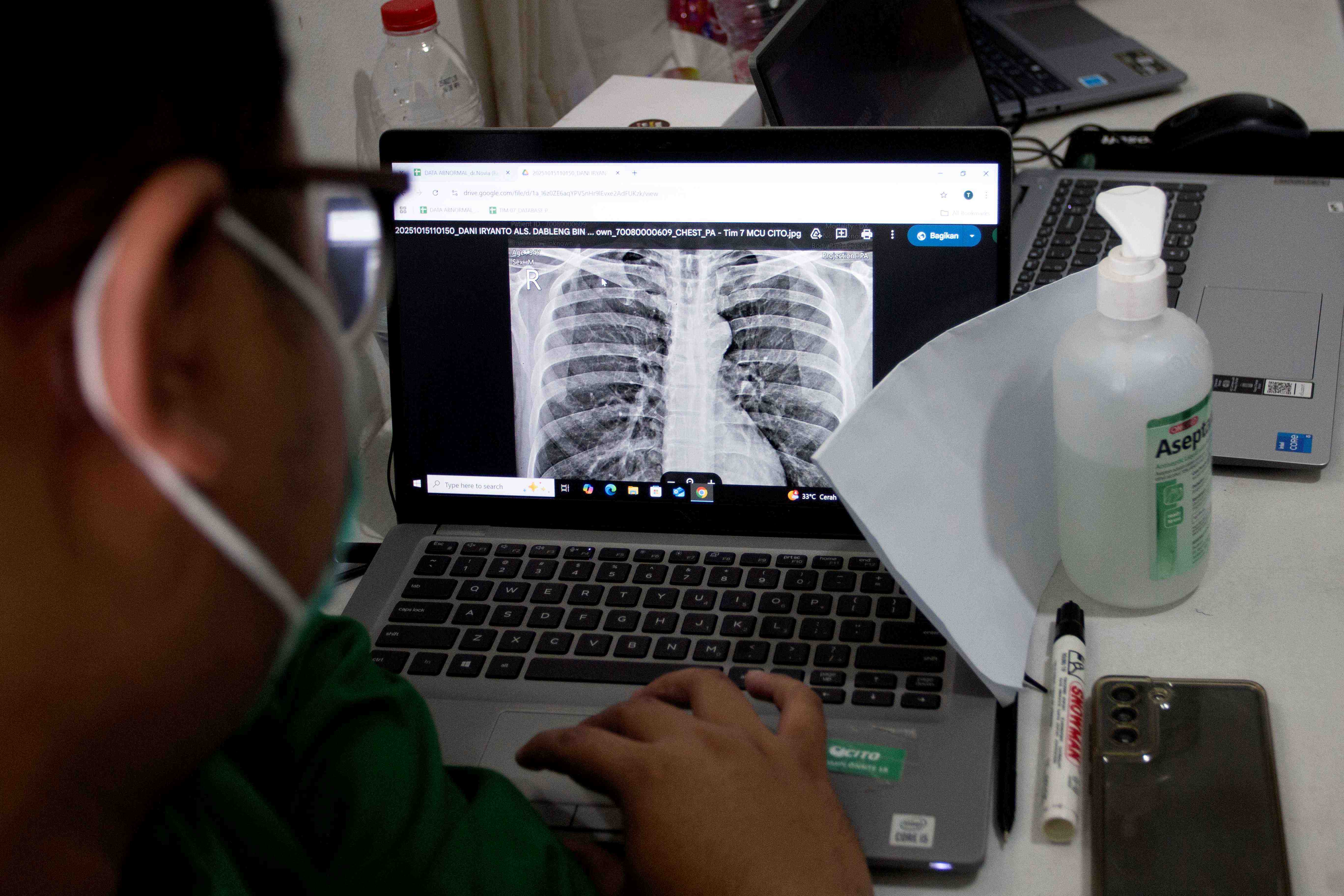 Tuntaskan TBC, Pemerintah Siapkan Perlindungan Sosial bagi Pekerja Informal